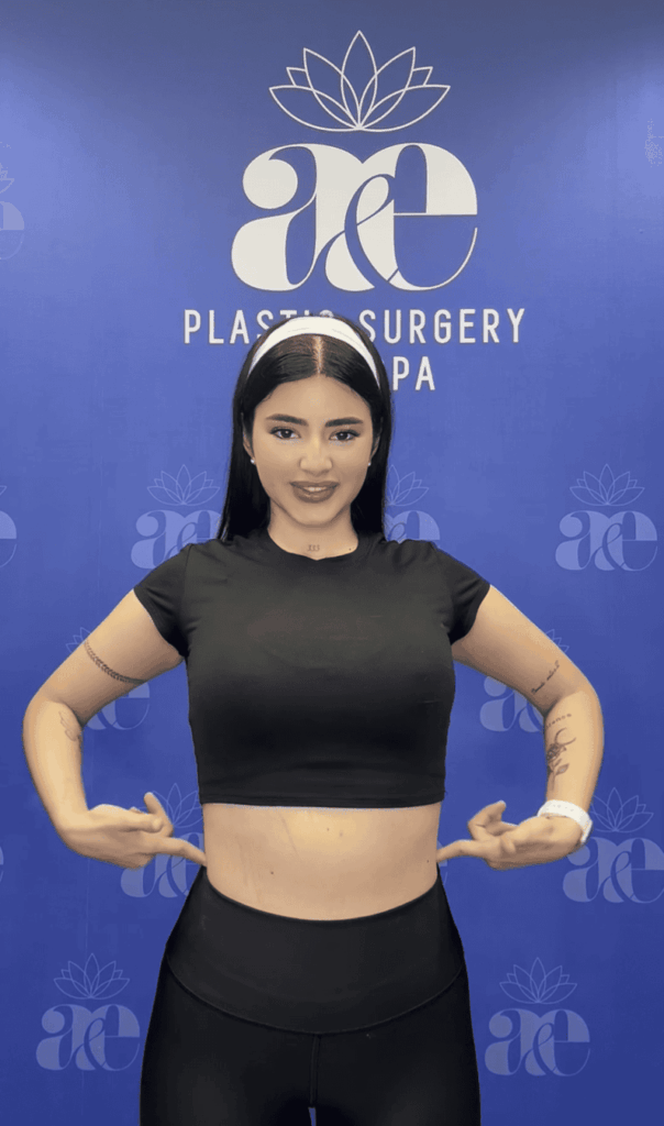 patient post-op photo showing toned midsection and confident results at A&E Plastic Surgery Miami