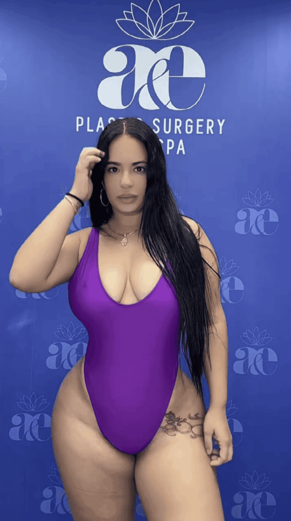 Latina patient showcasing BBL and breast augmentation results with hourglass figure at A&E Plastic Surgery Miami
